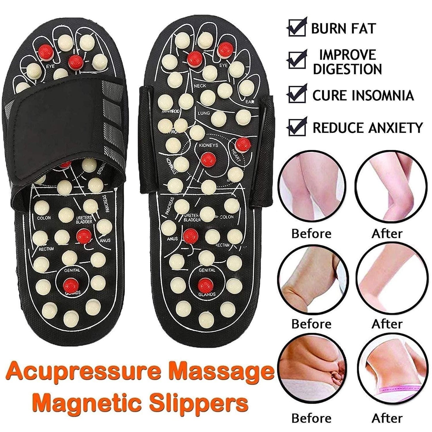 Acupressure Foot Massager Slippers | Pain Relief Reflexology Sandals